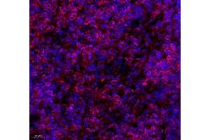 Immunofluorescence of paraffin embedded rat lymph node using septin1 (ABIN7074453) at dilution of 1: 650 (400x lens)