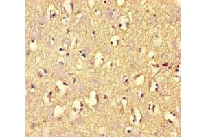 Immunohistochemistry of paraffin-embedded human brain tissue using ABIN7167960 at dilution of 1:100