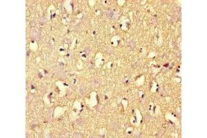 Immunohistochemistry of paraffin-embedded human brain tissue using ABIN7167960 at dilution of 1:100 (ARHGAP42 anticorps  (AA 541-728))