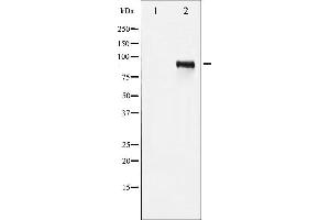 Western blot analysis of IGF1R phosphorylation expression in Insulin treated 293 whole cell lysates,The lane on the left is treated with the antigen-specific peptide.
