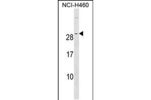 Western blot analysis in NCI-H460 cell line lysates (35ug/lane). (rala anticorps  (C-Term))