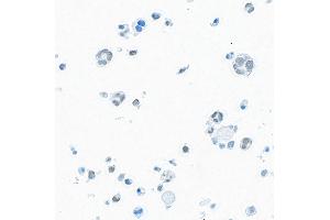 Immunocytochemistry (ICC) image for anti-Bromodomain Containing 9 (BRD9) (AA 547-597) antibody (ABIN7455162) (Recombinant BRD9 anticorps  (AA 547-597))