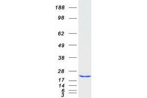 Validation with Western Blot