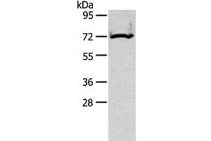 Western Blot analysis of Mouse kidney tissue using CPT2 Polyclonal Antibody at dilution of 1:200 (CPT2 anticorps)