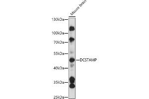 Western blot analysis of extracts of Mouse brain, using DCSTAMP antibody (ABIN7270939) at 1:3000 dilution. (Transmembrane 7 Superfamily Member 4 (TM7SF4) (AA 401-470) anticorps)