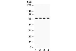 Western blot testing of 1) rat lung, human 2) HeLa, 3) HepG2 and 4) SMMC lysate with GRK5 antibody. (GRK5 anticorps)