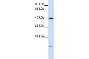 TMEM79 antibody used at 1 ug/ml to detect target protein. (TMEM79 anticorps  (C-Term))