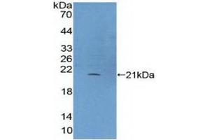 Detection of Recombinant PLCb3, Human using Polyclonal Antibody to Phospholipase C Beta 3, Phosphoinositide Specific (PLCb3)
