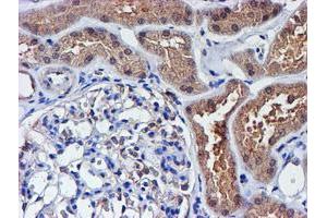 Image no. 9 for anti-Spermine Synthase, SMS (SMS) antibody (ABIN1501093)