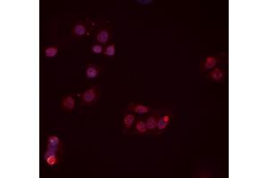 ABIN6277454 staining Hela cells by IF/ICC. (PPP2CB anticorps  (C-Term))