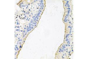 Immunohistochemistry of paraffin-embedded mouse lung using HPR antibody (ABIN6003630) at dilution of 1/100 (40x lens). (HPR anticorps)