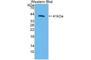 Detection of Recombinant MYO5A, Human using Polyclonal Antibody to Myosin VA (MYO5A) (MYO5A anticorps  (AA 1531-1855))