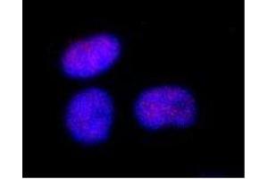 Immunofluorescence (IF) image for anti-SWI/SNF Related, Matrix Associated, Actin Dependent Regulator of Chromatin, Subfamily A, Member 4 (SMARCA4) (C-Term) antibody (ABIN2451926)