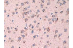 Detection of TPP1 in Mouse Brain Tissue using Polyclonal Antibody to Tripeptidyl Peptidase I (TPP1)