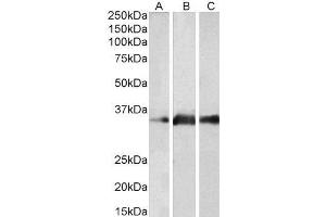 ABIN2563589 (2µg/ml) staining of Human Brain (Cerebellum) (A), Mouse Brain (B) and Rat Brain (C) lysates (35µg protein in RIPA buffer). (Kallikrein 5 anticorps  (Internal Region))