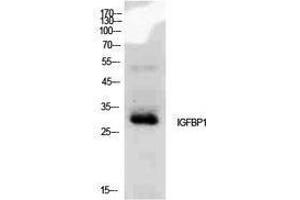 Western Blotting (WB) image for anti-Insulin-Like Growth Factor Binding Protein 1 (IGFBPI) (Internal Region) antibody (ABIN3188011) (IGFBPI anticorps  (Internal Region))