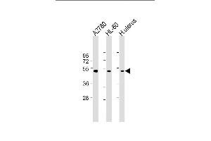 All lanes : Anti-B Antibody (Center) at 1:2000 dilution Lane 1:  whole cell lysate Lane 2: HL-60 whole cell lysate Lane 3: Human uterus lysate Lysates/proteins at 20 μg per lane. (BMP15 anticorps  (AA 241-271))