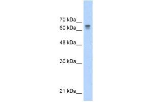 PARP6 antibody used at 0. (PARP6 anticorps)