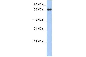 ZDHHC17 antibody used at 1 ug/ml to detect target protein. (ZDHHC17 anticorps  (Middle Region))