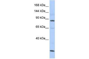 MSH5 antibody used at 1 ug/ml to detect target protein. (MSH5 anticorps)