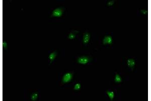 Immunofluorescence staining of U251 cells with ABIN7145872 at 1:250, counter-stained with DAPI. (BUD13 anticorps  (AA 132-233))