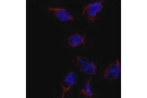Immunofluorescence analysis of BMP7 antibody and HeLa cells.