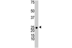 The KHK polyclonal antibody  is used in Western blot to detect KHK in 293 cell lysate . (Ketohexokinase anticorps  (N-Term))