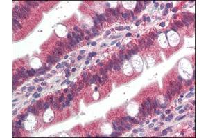 Human Small Intestine (formalin-fixed, paraffin-embedded) stained with FGFR1at 4 µg/ml followed by biotinylated anti-goat IgG secondary antibody, alkaline phosphatase-streptavidin and chromogen. (FGFR1 anticorps  (C-Term))