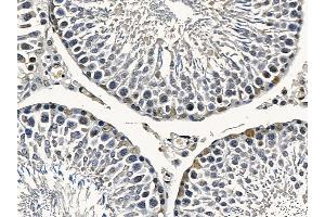 FOXO4 Mouse Monoclonal Antibody at 1/100 staining rat testis tissue by IHC-P. (FOXO4 anticorps  (Internal Region))