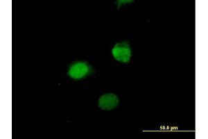 Immunofluorescence of purified MaxPab antibody to SESN3 on HeLa cell.