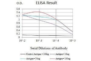 Black line: Control Antigen (100 ng),Purple line: Antigen (10 ng), Blue line: Antigen (50 ng), Red line:Antigen (100 ng)