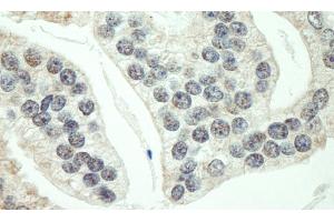 Immunohistochemistry (IHC) image for anti-Ring Finger Protein 40, E3 Ubiquitin Protein Ligase (RNF40) (AA 540-590) antibody (ABIN7453774)