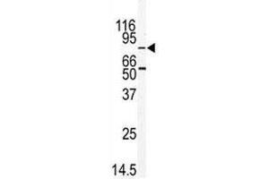 Western blot analysis of MARK2 antibody and mouse thymus tissue lysate