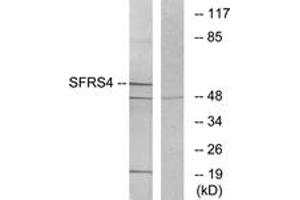 Western blot analysis of extracts from LOVO cells, using SFRS4 Antibody. (SRSF4 anticorps  (AA 111-160))