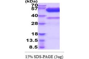 SDS-PAGE (SDS) image for Tumor Necrosis Factor Receptor Superfamily, Member 10d, Decoy with Truncated Death Domain (TNFRSF10D) (AA 56-211) (Active) protein (hIgG-His-tag) (ABIN6388134) (DcR2 Protein (AA 56-211) (hIgG-His-tag))