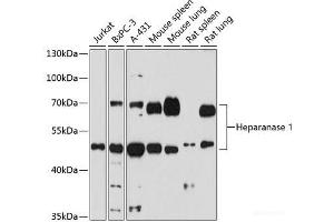 Western blot analysis of extracts of various cells using Heparanase 1 Polyclonal Antibody at dilution of 1:1000. (HPSE anticorps)