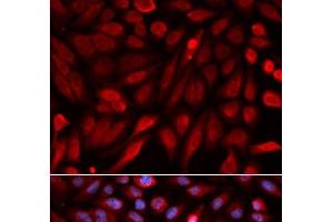 Immunofluorescence analysis of U2OS cells using SDCBP Polyclonal Antibody (SDCBP anticorps)