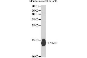 Western blot analysis of extracts of mouse skeletal muscle, using PVALB antibody (ABIN5971476) at 1:400 dilution. (PVALB anticorps)