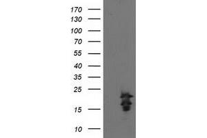 Western Blotting (WB) image for anti-Fibroblast Growth Factor 21 (FGF21) antibody (ABIN1498256) (FGF21 anticorps)