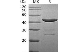 Western Blotting (WB) image for Indoleamine 2,3-Dioxygenase 1 (IDO1) protein (His tag) (ABIN7320560)