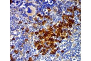 IHC testing of mouse spleen stained with CD63 antibody (MX49. (CD63 anticorps)