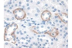 Detection of STAM2 in Mouse Kidney Tissue using Polyclonal Antibody to Signal Transducing Adaptor Molecule 2 (STAM2)