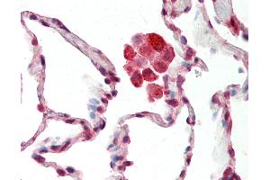 Anti-NDUFS8 antibody IHC staining of human lung. (NDUFS8 anticorps  (C-Term))