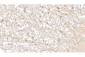 Detection of DUSP3 in Human Spinal cord Tissue using Monoclonal Antibody to Dual Specificity Phosphatase 3 (DUSP3)