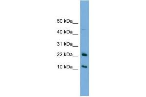 WB Suggested Anti-GM2A Antibody Titration:  0. (GM2A anticorps  (N-Term))