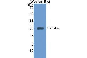 Western Blotting (WB) image for anti-Retinol Binding Protein 5, Cellular (RBP5) (AA 19-201) antibody (ABIN1860414) (Retinol Binding Protein 5 anticorps  (AA 19-201))