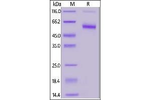 Fed Human CD7, Llama IgG2b Fc Tag on  under reducing (R) condition. (CD7 Protein (CD7) (AA 26-180) (lFc Tag,FITC))