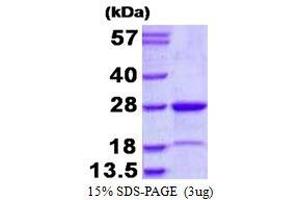 Image no. 1 for Muted Homolog (MUTED) (AA 1-187) protein (His tag) (ABIN6386995)