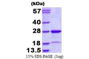 Image no. 1 for Muted Homolog (MUTED) protein (His tag) (ABIN1098338) (MUTED Protein (His tag))