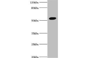 Western blot All lanes: Zinc finger protein AEBP2 antibody at 4 μg/mL + Hela whole cell lysate Secondary Goat polyclonal to rabbit IgG at 1/10000 dilution Predicted band size: 55, 53, 34 kDa Observed band size: 55 kDa